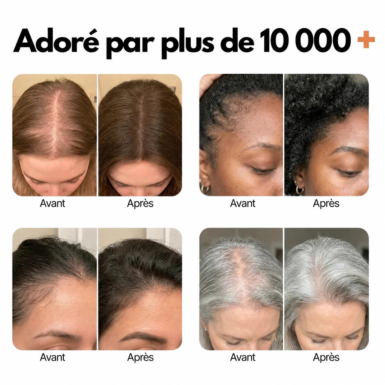 Sérum pour la croissance des cheveux