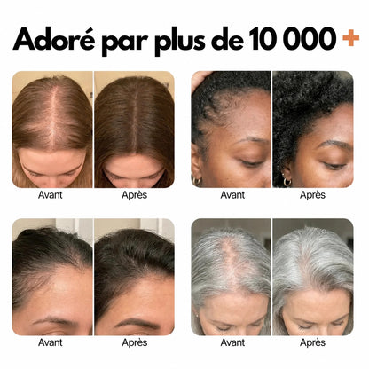 Sérum pour la croissance des cheveux