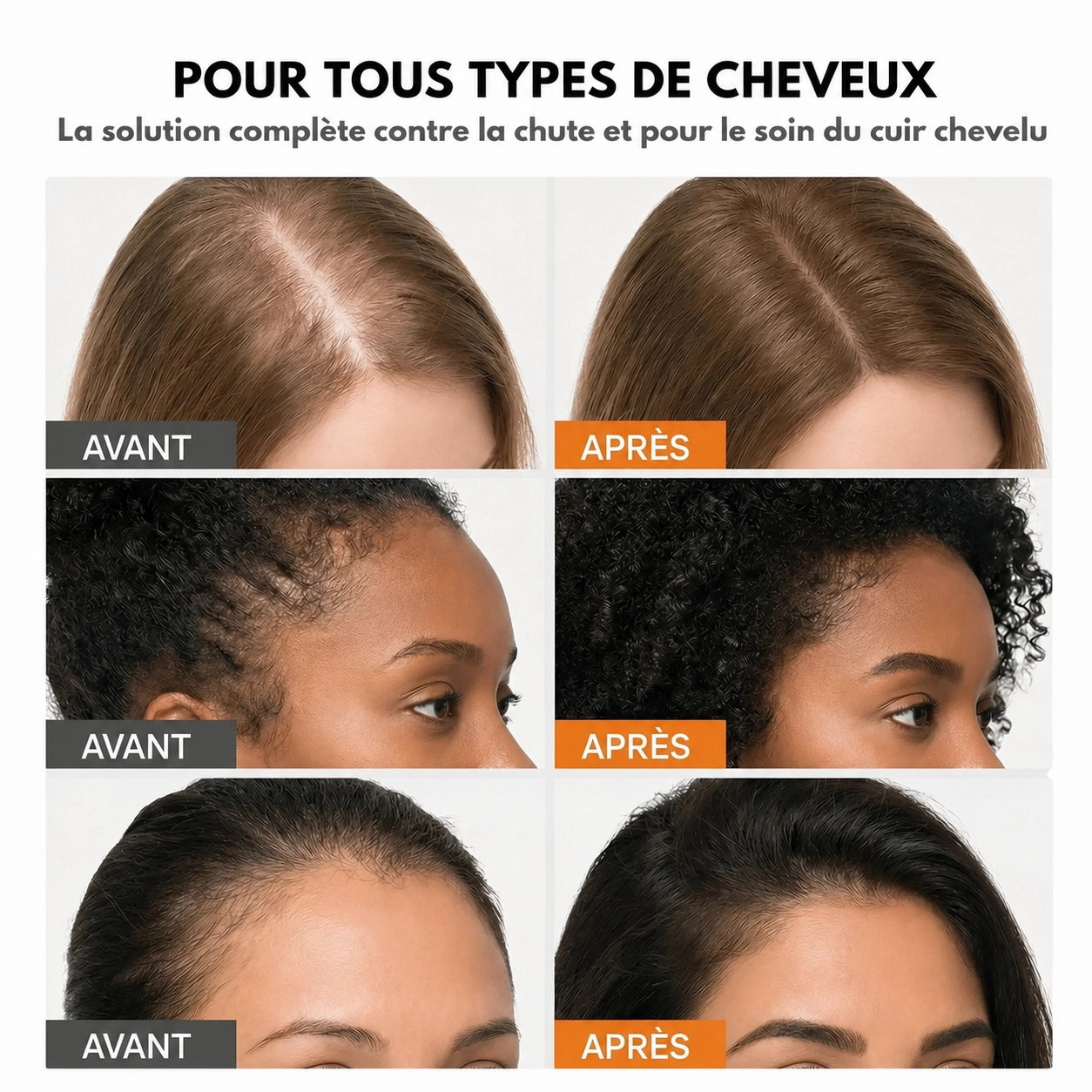 Sérum pour la croissance des cheveux